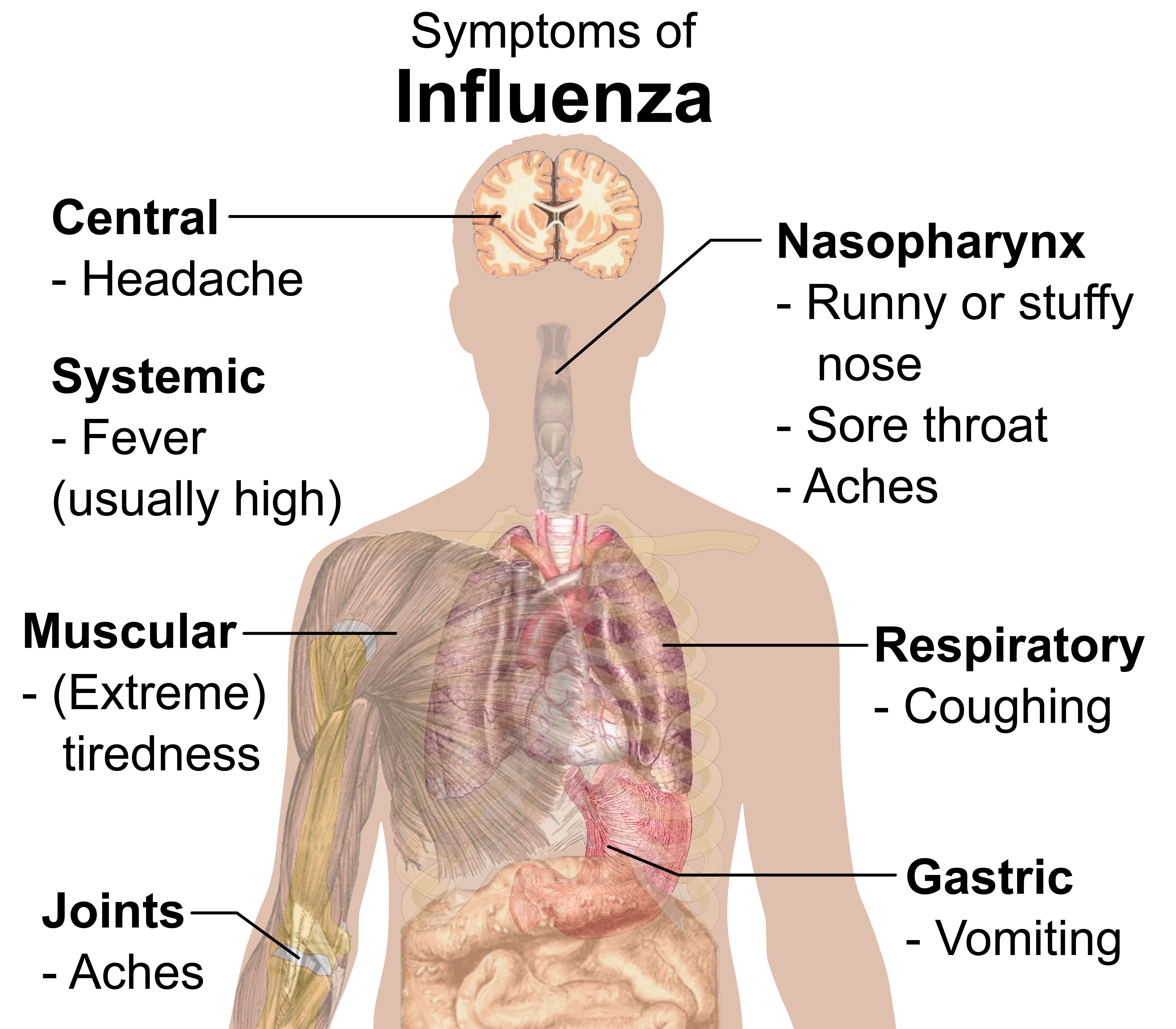 symptoms of flu or influenza- is it flu or sinus infection